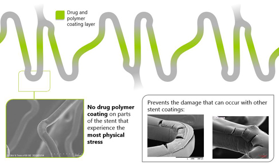 Ultimaster® - Drug eluting stent